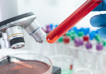 USP publica edital para seleção de professor da área de  Processos Bioquímicos Industriais